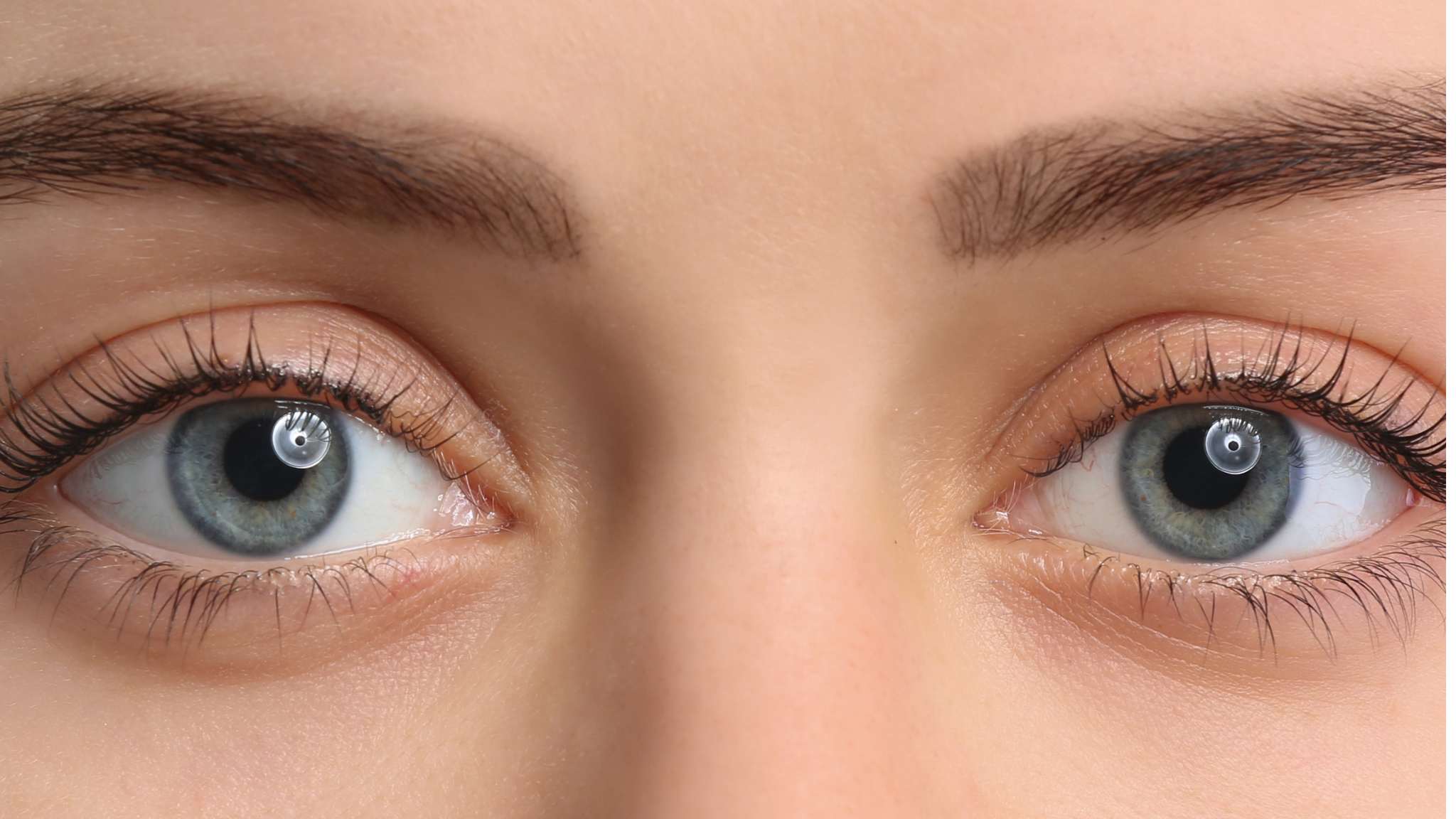 Eye Floaters Adalah: Penyebab, Gejala, & Cara Mengatasinya